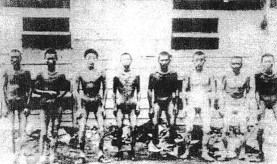 Chinese laborers surviving the Hanaoka Mine in Akita Prefecture undergoing medical examinations by the US military after the war